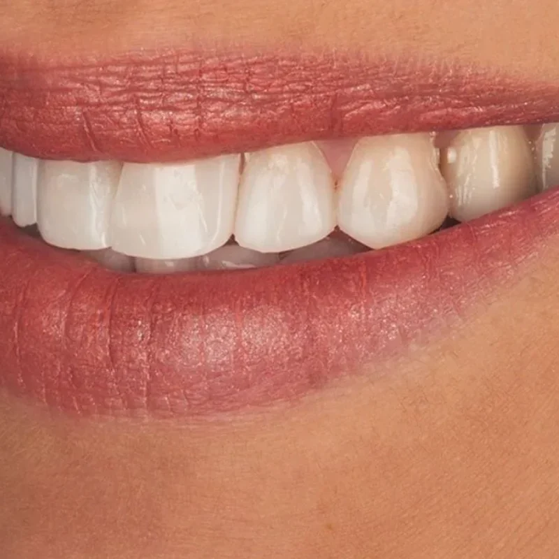 Avaliação de prótese dentária no Prado, Belo Horizonte, Dentistas BH